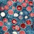 Covid, monkeypox, polio: Summer of viruses reflects travel, warming trends