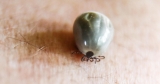 Summertime means it’s tick season, so here are tips to protect yourself