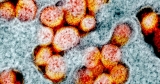 Health officials “keeping a very close eye” on COVID-19 Mu variant