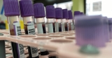 1st suspected case of human-to-dog monkeypox transmission leads CDC to update guidance on the virus