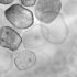 Do You Need A Fourth Shot Of Covid Vaccine? Here Is What Experts Say As Cases Rise