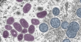 CDC confirms 16 monkeypox cases in Indiana – WISH-TV | Indianapolis News | Indiana Weather