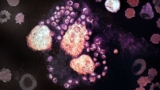 HIV patients who get leishmaniasis face a tough road. But now there's new hope : Goats and Soda – NPR