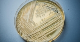 Outbreaks of a drug-resistant superbug fungus spread in two U.S. cities, CDC reports