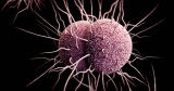 CDC updates STI treatment guidelines for first time since 2015
