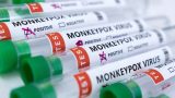 Monkeypox cases drop 21% globally, reversing month-long increase: WHO