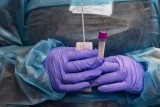 Medical experts urge caution as COVID case numbers rise in Boston