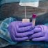 How the CDC Can Build Trust Around Monkeypox Shots