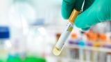 CDC investigating 109 mysterious pediatric hepatitis cases, including 5 deaths