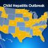 California coronavirus updates: Employers added nearly 430,000 jobs last month despite inflation