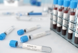 COVID-19 mortality rate five times higher among labor, retail and service workers, study reveals