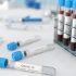 CDC testing confirms monkeypox in Philly resident