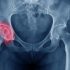 World Thrombosis Day Campaign Unites Thousands of Global Partners to Shine a Spotlight on Blood Clots as an Urgent Health Problem