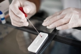 Diagnosed HIV cases plummet during pandemic — but that’s probably bad news