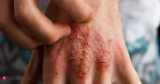 persistent pain which needs ‘mindfulness’, Health News, ET HealthWorld