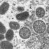 Symptoms, vaccine, treatment options and more