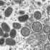Oklahoma seeing increase in COVID-19 cases as omicron subvariants rage