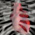 Almost two-thirds of long Covid patients are women, study finds