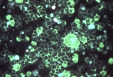 Pandemic ‘immunity gap’ is probably behind surge in RSV cases, scientists say