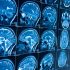 L.A. County reported 1,641 more cases and 13 more deaths, Sept. 23 – Daily News