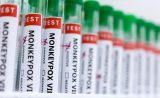 France Confirms 51 Monkeypox Cases: Health Official
