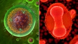 In Patients With Untreated AIDS, Monkeypox Can Be Life-Threatening