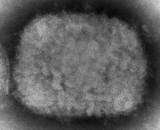Second suspected Sacramento monkeypox case found in close contact of first patient