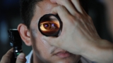 World Sight Day: WHO Urges Countries to Make Eye Health Services Accessible and Affordable