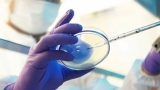 After UK’s First Death Due to Lassa Fever, Concerns Ripe Over Its ‘Pandemic Potential’! Here’s All You Need to Know | The Weather Channel – Articles from The Weather Channel