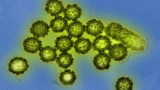 Canada is seeing an early rise in flu cases. Is a ‘tidal wave’ of infection coming?