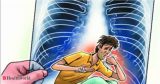 TB elimination is a people’s agenda, Health News, ET HealthWorld