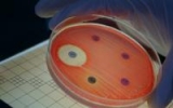 CDC study highlights community spread of superbugs
