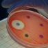 Axcella flunks long Covid PhII primary goal — but plots a path into PhIII – Endpoints News