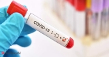 Japan reports Covid spike, medical system overwhelmed, Health News, ET HealthWorld