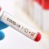 New study suggests covid increases risks of brain disorders