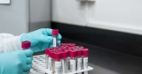 Monkeypox continues to spread in Florida as Orange County reports first case