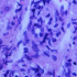 CDC Issues Travel Alert as WHO Downplays Monkeypox Pandemic Risk