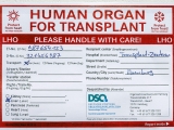 Doctors successfully transplant human liver treated in a machine