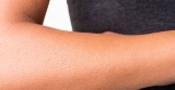 Paresthesia | Long COVID: A sensation on your skin can linger on for months