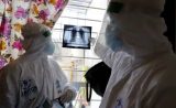 Double-lung transplants rise after corona ‘Honeycombs’ organs