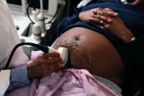 After CDC report, what can be done to prevent more maternal mortality deaths?