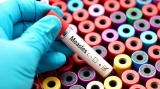 ‘Measles deaths’: Health ministry sends team to Mumbai