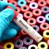 CDC investigating multi-state listeria outbreak linked to deli meat, cheese