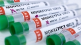 NBC News: Monkeypox chiefly transmitted through sex between men, suggests CDC update communications strategy