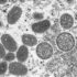 Johnson County reported 424 additional COVID-19 cases this week