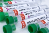 WATCH: White House monkeypox response team says U.S. will stretch vaccine supply with smaller doses