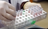 Monkeypox case confirmed in Texas man who traveled from Nigeria, CDC says
