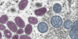 Travel | Monkeypox | Poxvirus