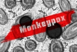Expert discusses monkeypox and the danger posed by zoonotic diseases