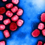 Monkeypox: Is history repeating itself?
